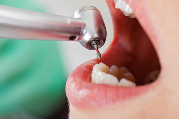 Best Emergency Treatment for Toothache in Waldpt, OR